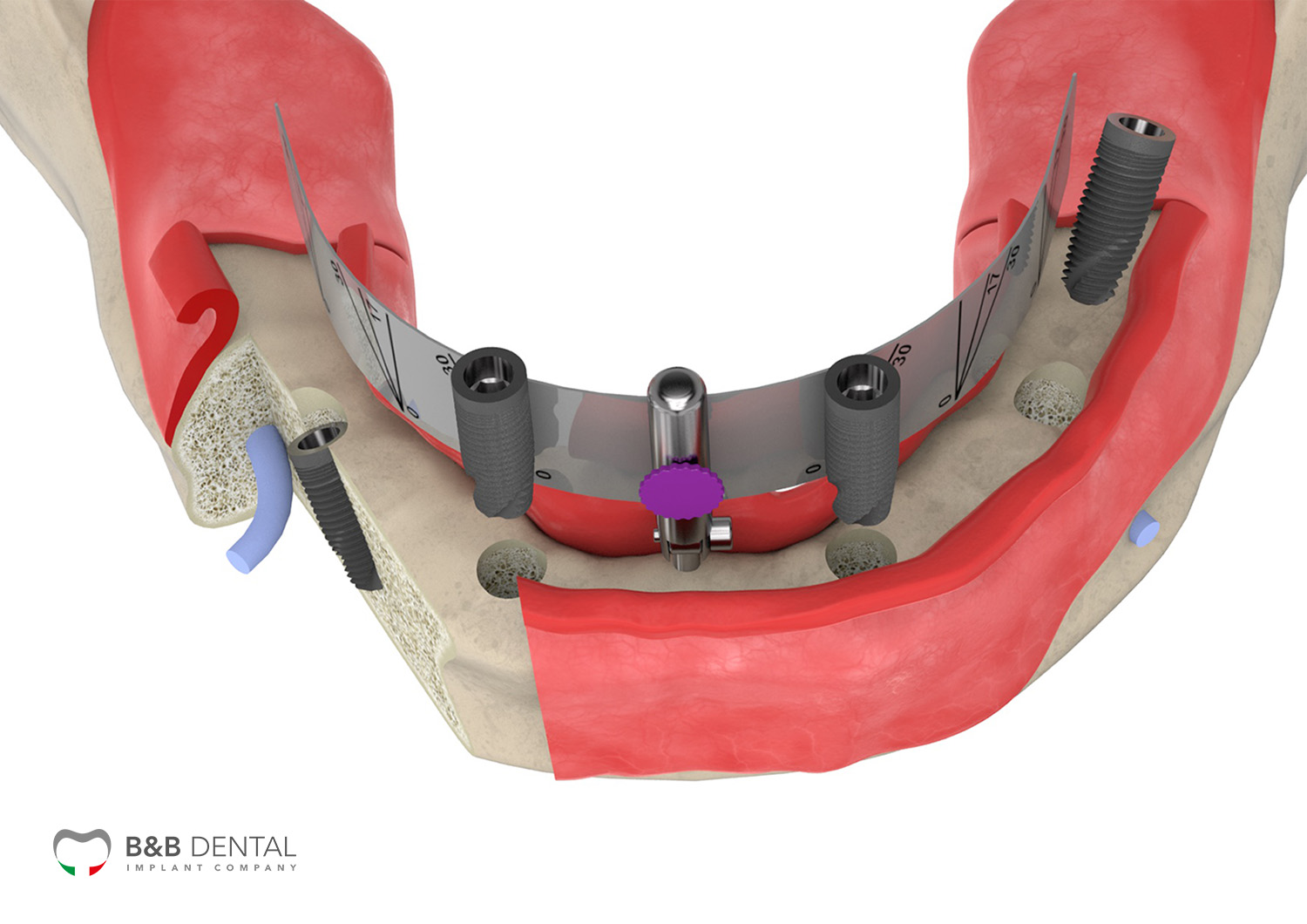 Rendering arcata dentale